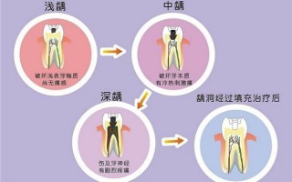 美容牙科网络运营模式，美容牙科和口腔科区别